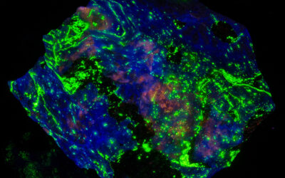 Cataract Surgery and Fluorescent Minerals: Changes in Color and UV Sensitivity