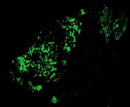 Fluorescence under shortwave UV light.